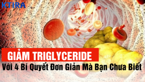 4 Bí quyết giảm triglyceride hiệu quả