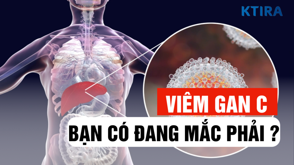 VIÊM GAN C