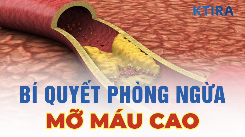 Phòng ngừa mỡ máu cao Ktira