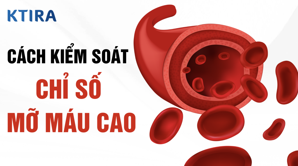 chỉ số mỡ máu cao ktira