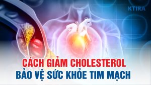 Cách giảm cholesterol hiệu quả