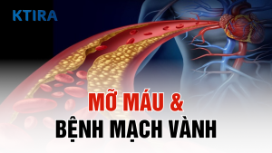 Mỡ máu và bệnh mạch vành