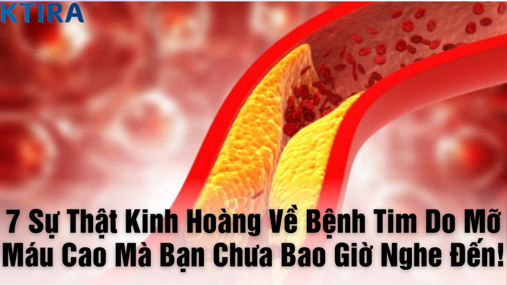 7 Sự Thật Về Bệnh Tim Do Mỡ Máu