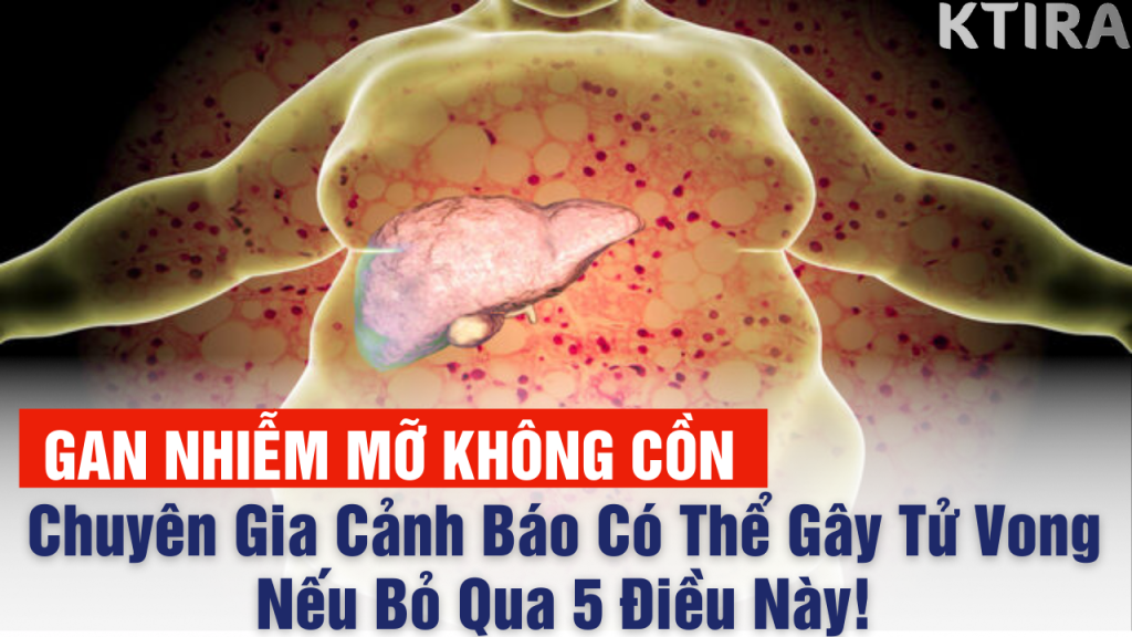 Gan nhiễm mỡ không cồn và dấu hiệu cảnh báo