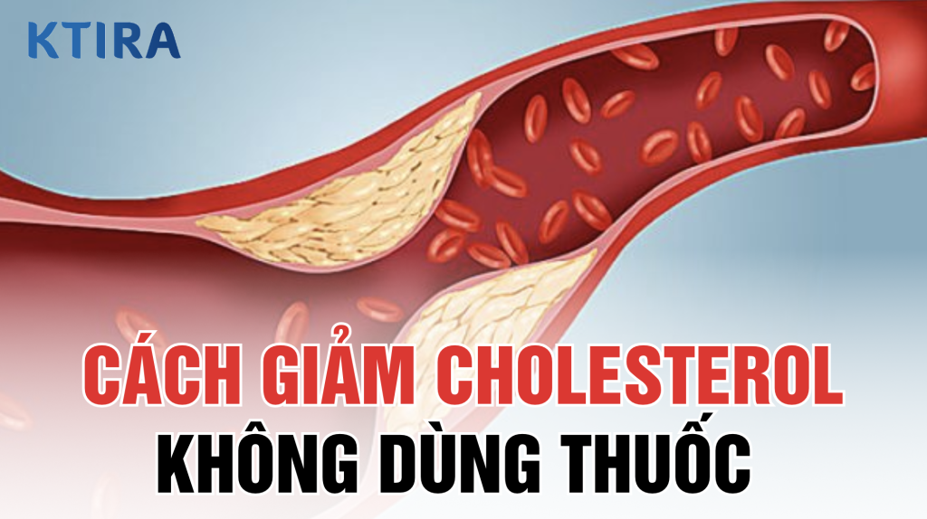 Cách giảm cholesterol không dùng thuốc KTIRA
