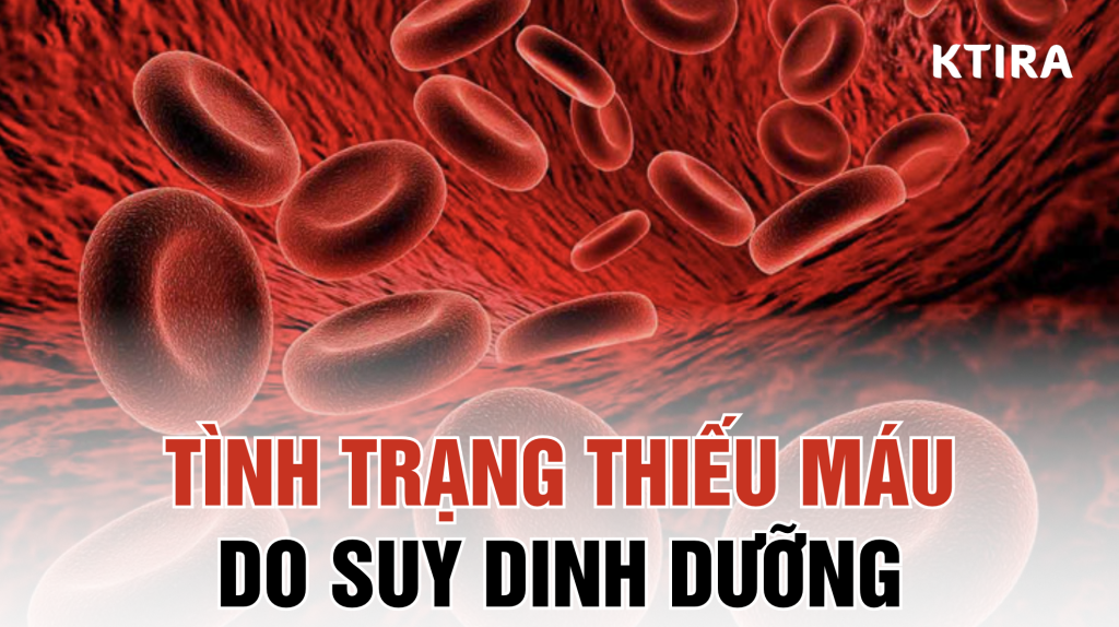 Thiếu máu do suy dinh dưỡng ktira