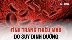 Thiếu máu do suy dinh dưỡng ktira