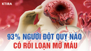 Mỡ Máu Cao Và Nguy Cơ Đột Quỵ ktira
