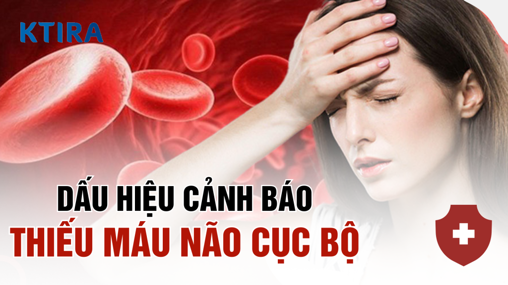 Dấu hiệu cảnh báo thiếu máu não cục bộ