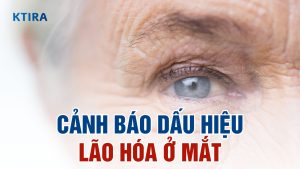 4 Dấu Hiệu Lão Hóa Mà Bạn Chưa Biết