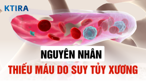 Nguyên nhân thiếu máu do suy tủy xương