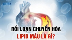 Rối loạn chuyển hóa lipid máu