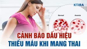 3 dấu hiệu thiếu máu ở phụ nữ mang thai
