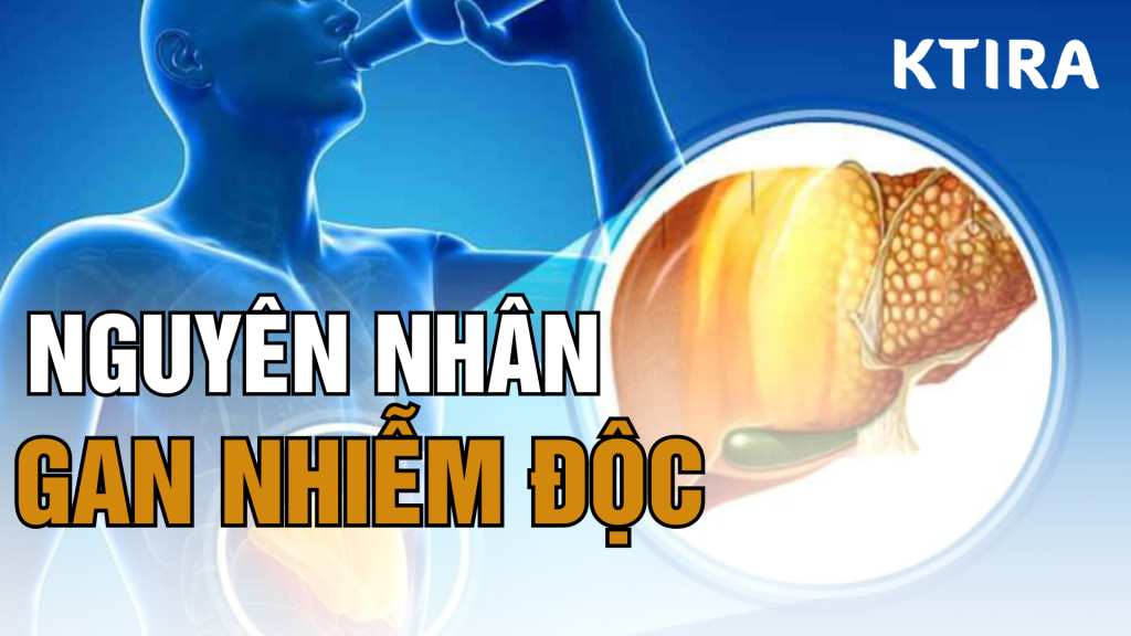 Nguyên nhân gây gan nhiễm độc