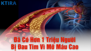Đã có hơn 1 triệu người đau tim vì mỡ máu.