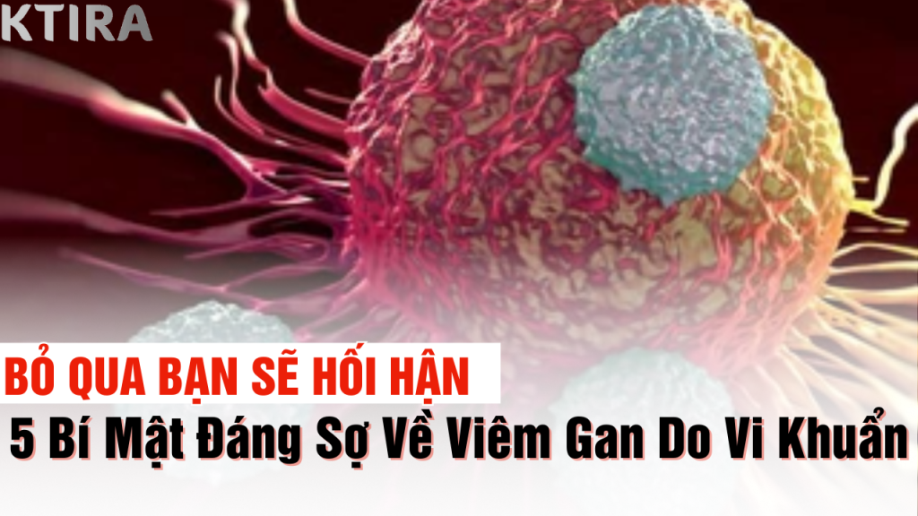 5 bí mật về viêm gan do vi khuẩn