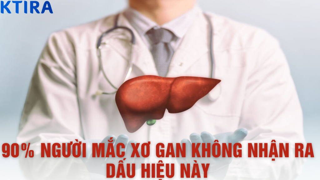 90% Người Mắc Xơ Gan Không Nhận Ra Dấu Hiệu Này