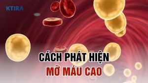 Cách phát hiện mỡ máu cao