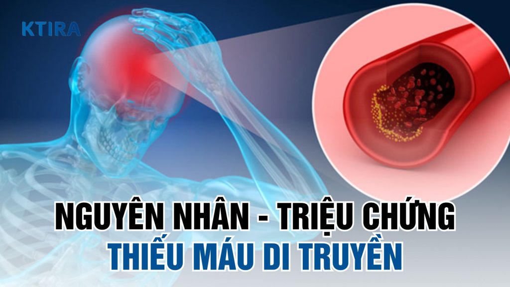 Khám phá thiếu máu di truyền