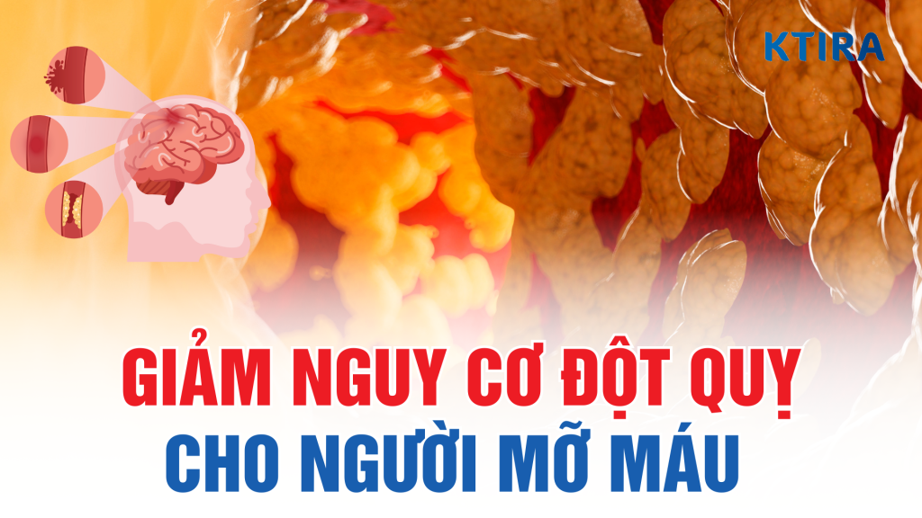 Giảm nguy cơ đột quỵ ở người mỡ máu cao