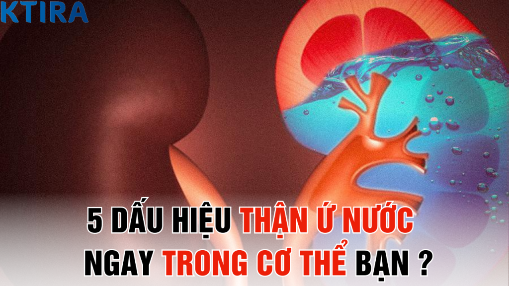 Dấu hiệu thận ứ nước xuất hiện ngay trong cơ thể bạn – Nhận ra trước khi quá muộn!
