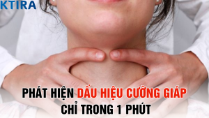 Phát Hiện Dấu Hiệu Cường Giáp Chỉ Trong 1 Phút