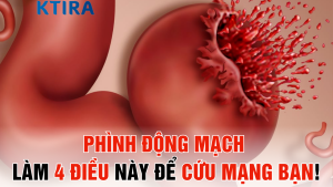 Phình Động Mạch: Làm 4 Điều Này Ngay Hôm Nay Để Cứu Mạng Bạn!