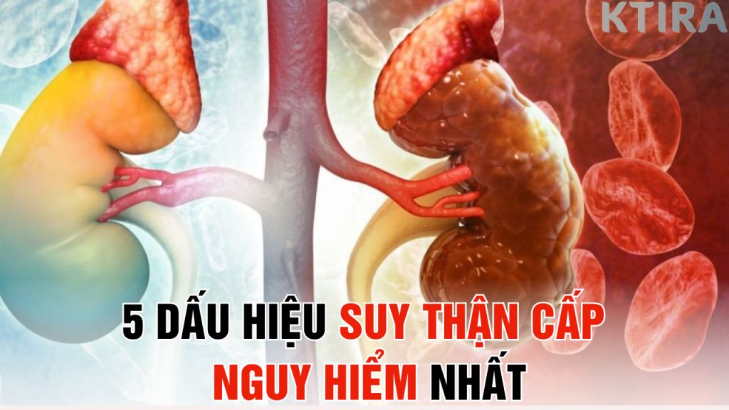 5 Dấu Hiệu Suy Thận Cấp Nguy Hiểm Nhất – Biết Sớm Để Cứu Thận!