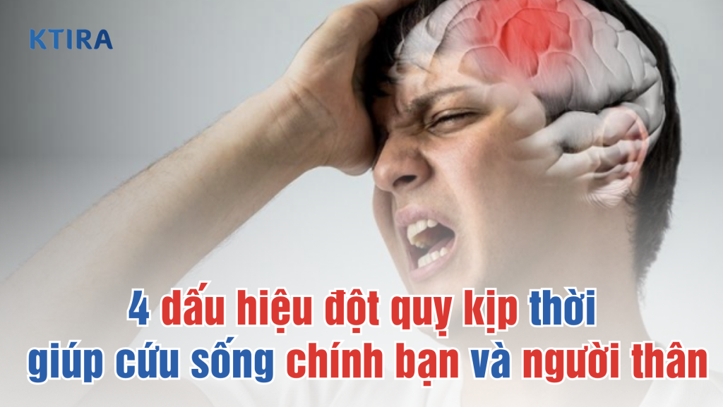 các dấu hiệu đột quỵ ktira