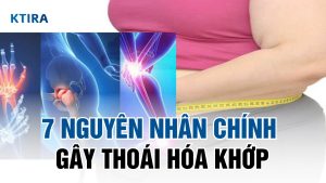 Nguyên nhân gây thoái hóa khớp