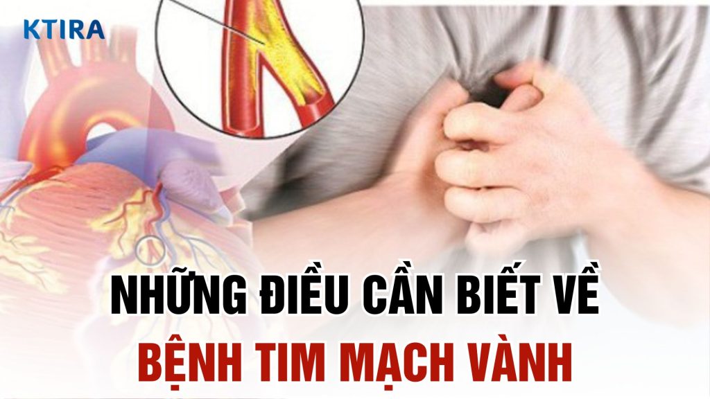Bệnh tim mạch vành