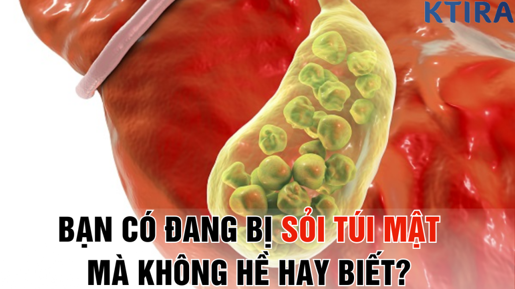 bạn có đang bị sỏi túi mật mà không hề hay biết?