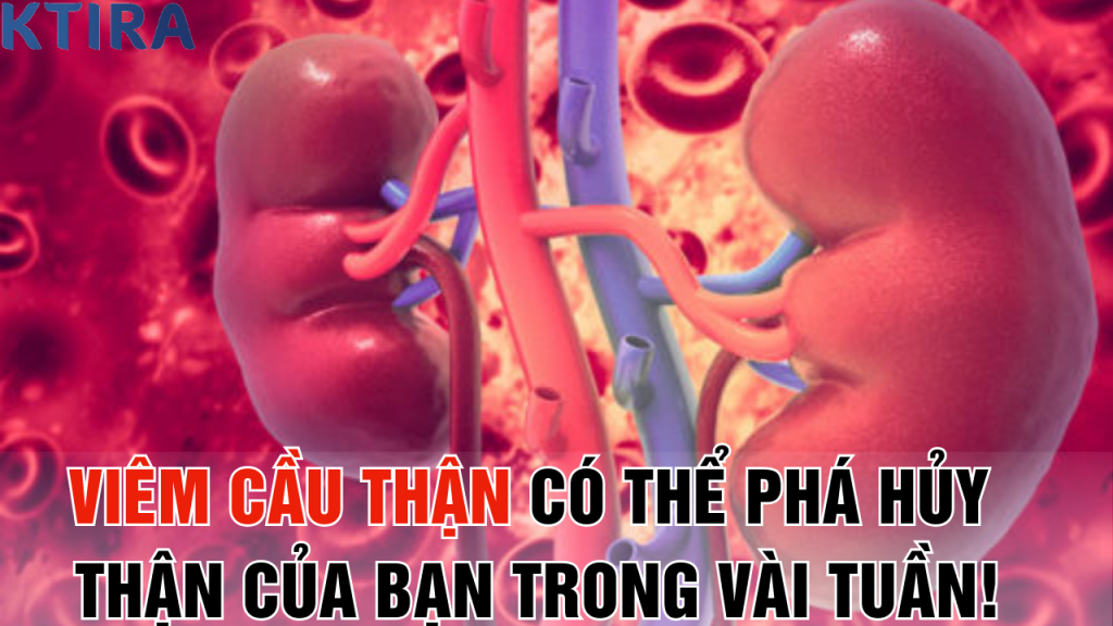 Viêm Cầu Thận Có Thể Phá Hủy Thận Của Bạn Trong Vài Tuần!
