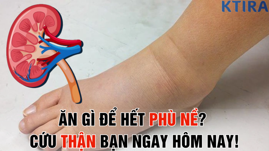 5 Thực Phẩm “Thần Kỳ” Giảm Phù Nề và Bảo Vệ Thận