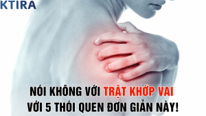 Nói Không Với Trật Khớp Vai với 5 Thói Quen Đơn Giản Này!