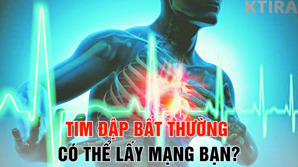 Tim Đập Bất Thường Có Thể Lấy Mạng Bạn