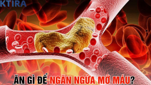 Ăn Gì Để Ngăn Ngừa Mỡ Máu? 5 Loại Thực Phẩm Này Có Thể Cứu Sống Bạn!