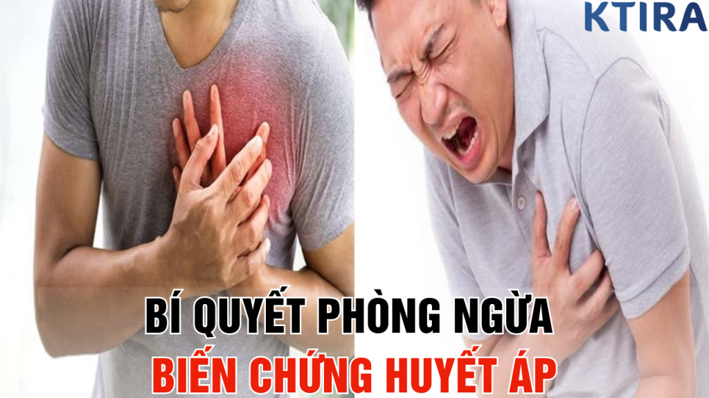 Bí Quyết Phòng Ngừa Biến Chứng Huyết Áp