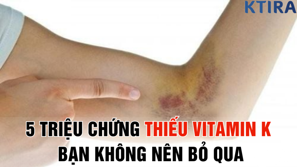 5 Triệu Chứng Thiếu Vitamin K Bạn Không Nên Bỏ Qua
