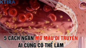 5 Cách Ngăn Mỡ Máu Di Truyền Ai Cũng Có Thể Làm