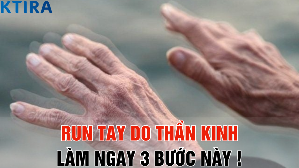 Run tay do thần kinh: Làm ngay 3 bước này trước khi quá muộn!