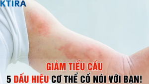 Giảm Tiểu Cầu 5 Dấu Hiệu Cơ Thể Cố Nói Với Bạn!