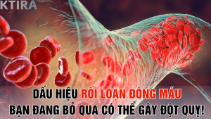 Dấu Hiệu Rối Loạn Đông Máu Bạn Đang Bỏ Qua Có Thể Gây Đột Quỵ!