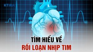 Tìm hiểu về rối loạn nhịp tim