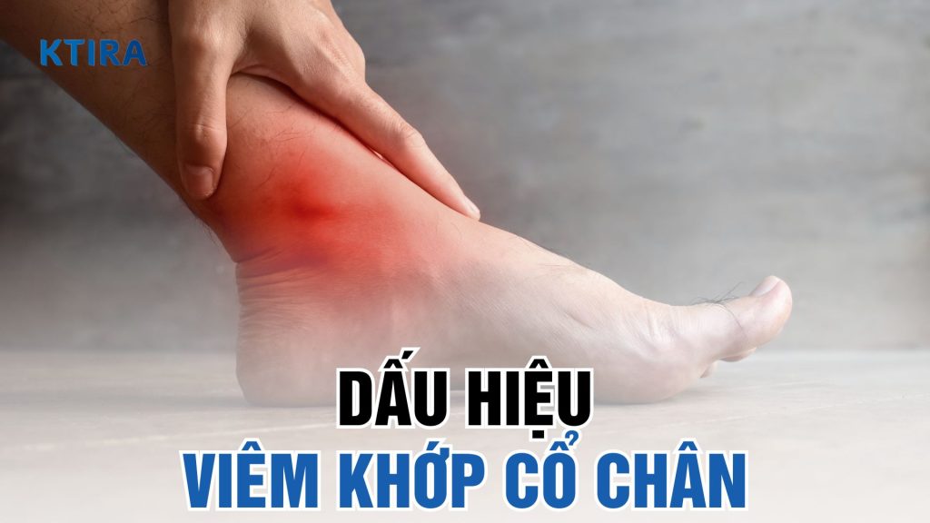 Nhận biết viêm khớp cổ chân