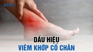 Nhận biết viêm khớp cổ chân