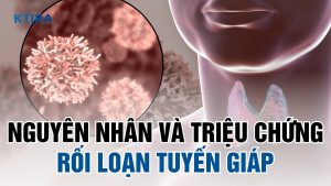 Rối loạn tuyến giáp