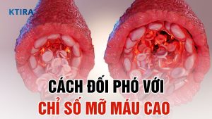 Cách đối phó với chỉ số mỡ máu cao