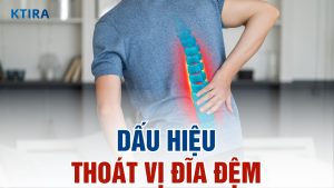 Dấu hiệu thoát vị đĩa đệm