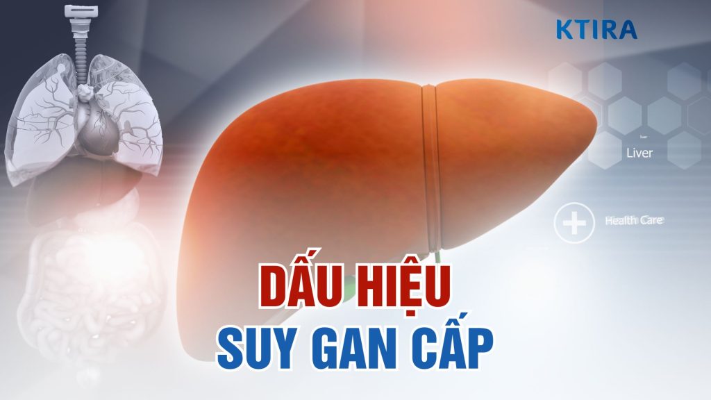 Dấu hiệu suy gan cấp